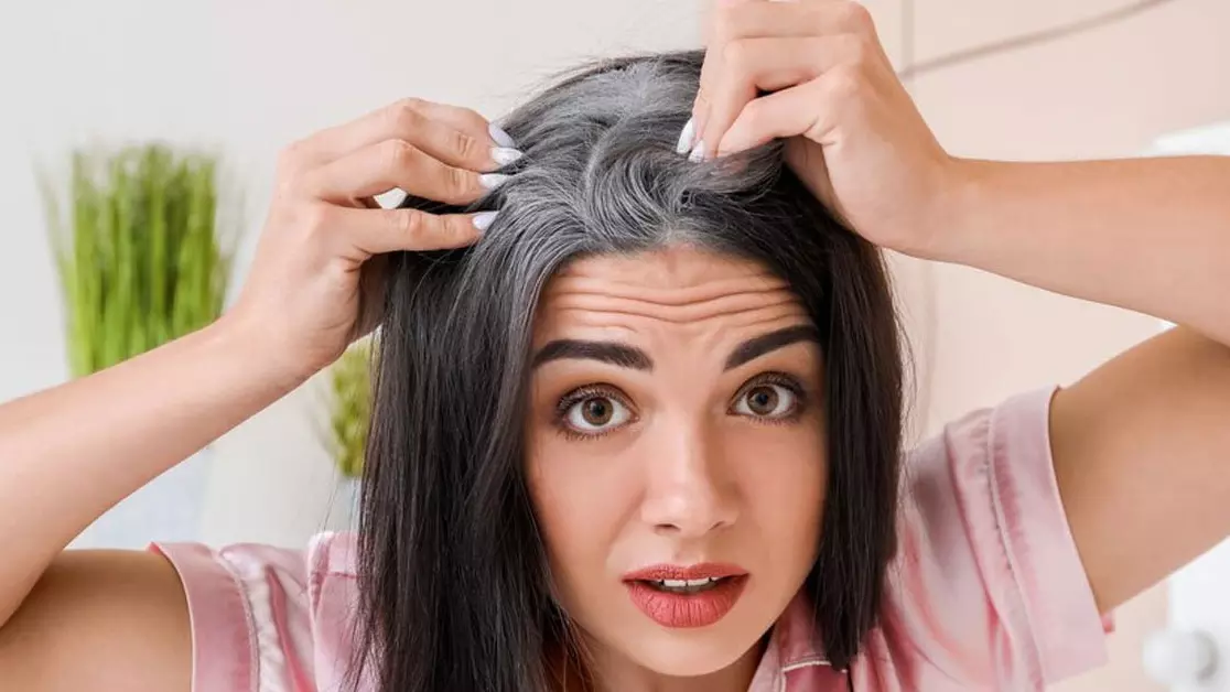 इन घरेलू उपायों से दूर होंगे बालों के डैंड्रफ