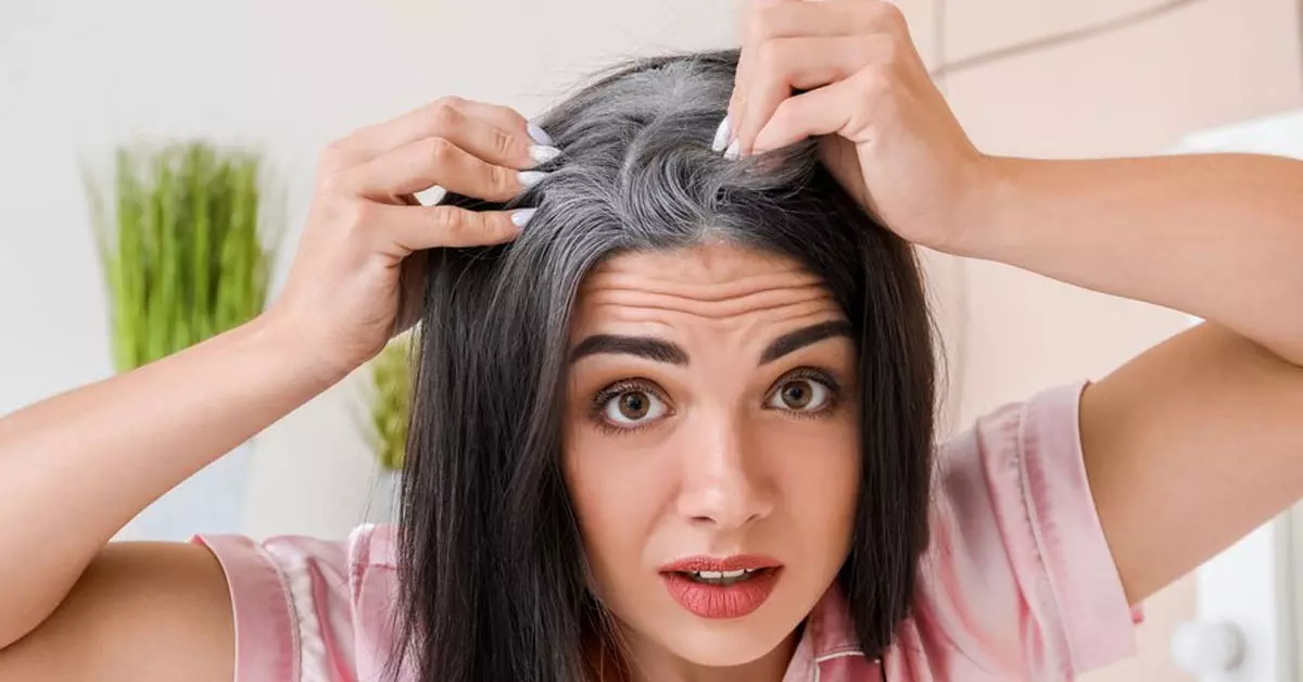 इन घरेलू उपायों से दूर होंगे बालों के डैंड्रफ