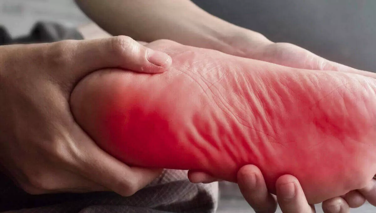 पैरों के तलवों की जलन इन घर में रखीं इन चीजों से करें शांत