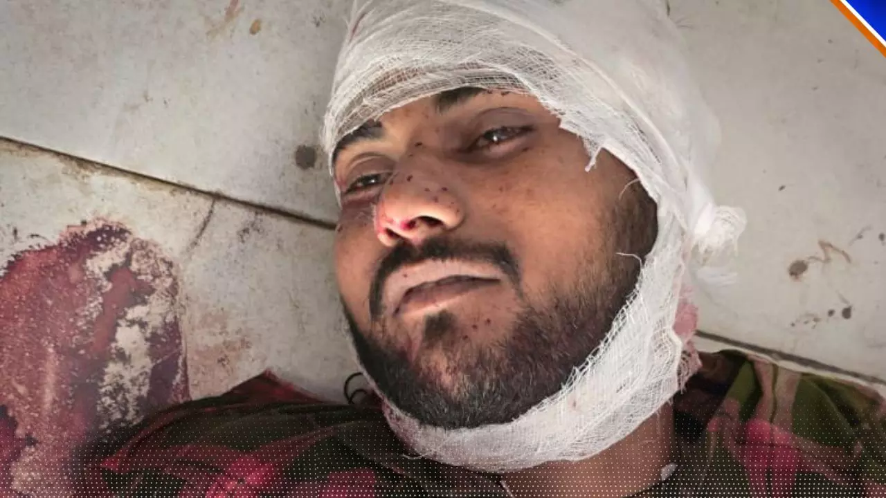 पुलिस मुठभेड़ में ढेर हुआ बदमाश, डेढ लाख का था इनाम; पुलिसकर्मी को भी लगी गोली