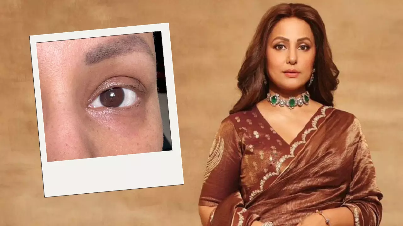 कैंसर से जंग लड़ रहीं Hina Khan ने शेयर की अपनी आखिरी बची हुई आईलैश की तस्वीर, ल‍िखा इमोशनल पोस्‍ट