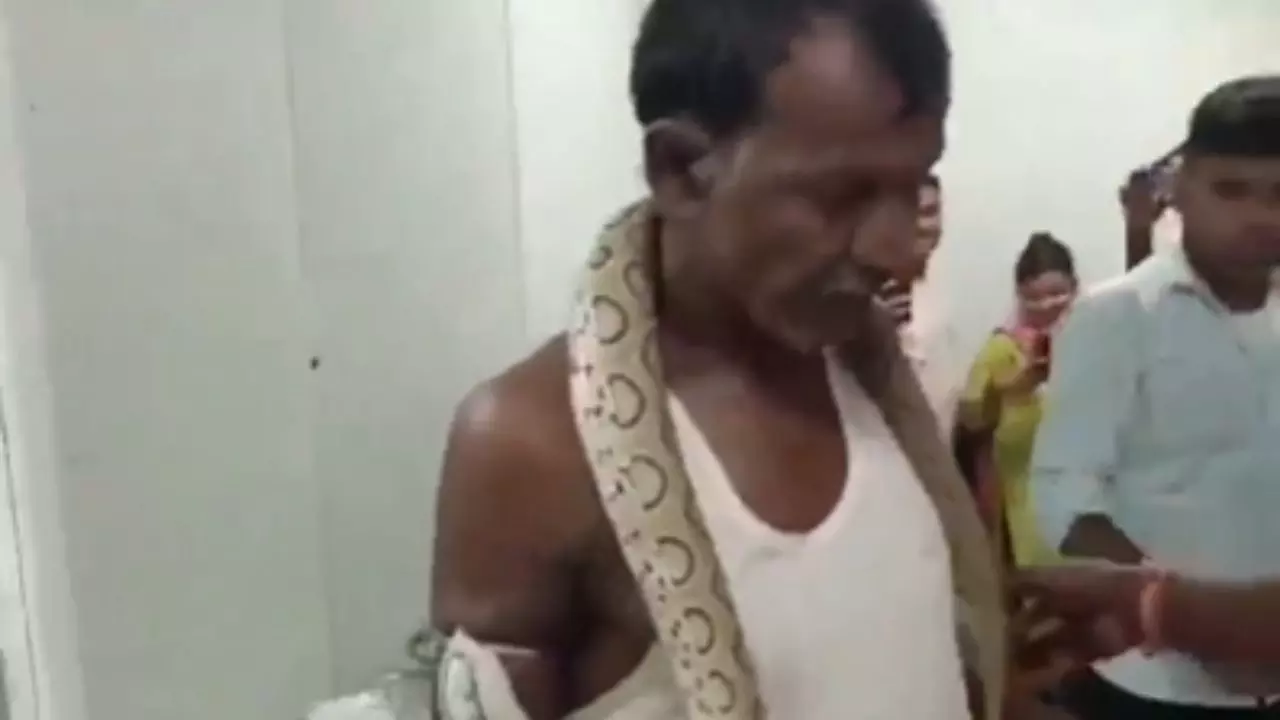 सांप ने काटा तो गले में टांगकर अस्पताल पहुंचा शख्स, देखते ही डॉक्टर के उड़े होश