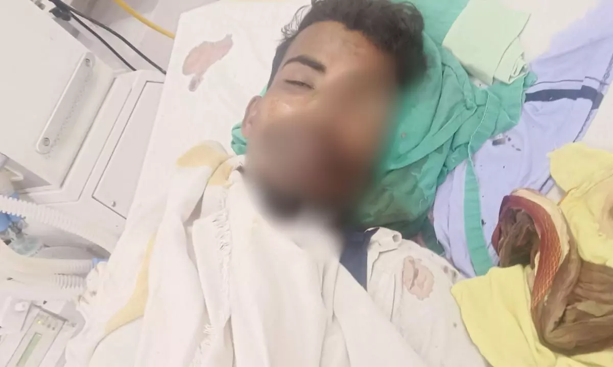 गोली पेट में लगी और मरने के बाद गायब हो गई आंख, डॉक्टर का अनोखा जवाब- चूहे ने कुतर दी गोली पेट में लगी और मरने के बाद गायब हो गई आंख, डॉक्टर का अनोखा जवाब- चूहे ने कुतर दी