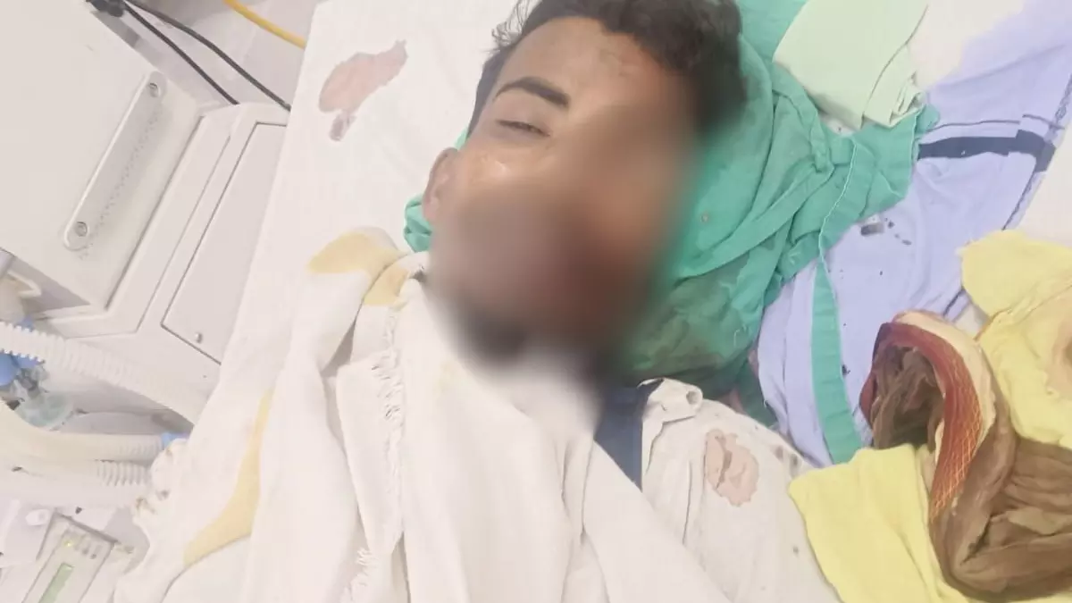 गोली पेट में लगी और मरने के बाद गायब हो गई आंख, डॉक्टर का अनोखा जवाब- चूहे ने कुतर दी