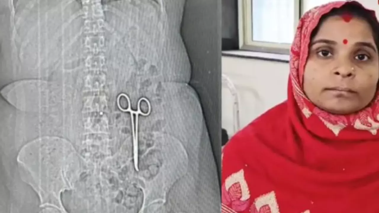 दो साल से पेट में कैंची, कैंसर के ऑपरेशन में डॉक्टर की लापरवाही