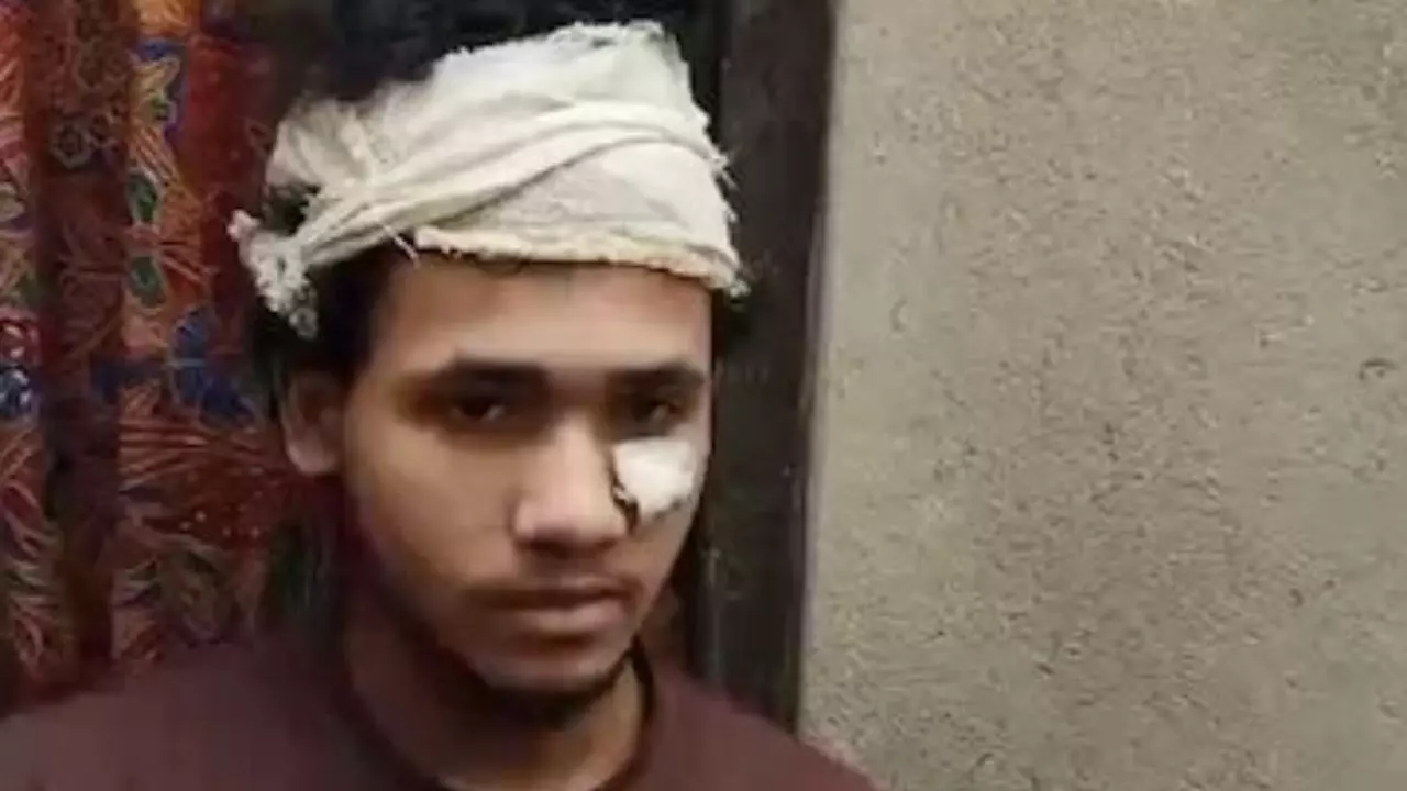 मुझे बांग्लादेश पसंद था, लेकिन फिर कभी नहीं जाउंगा, युवक ने सुनाई हमले की दर्दनाक कहानी मुझे बांग्लादेश पसंद था, लेकिन फिर कभी नहीं जाउंगा, युवक ने सुनाई हमले की दर्दनाक कहानी
