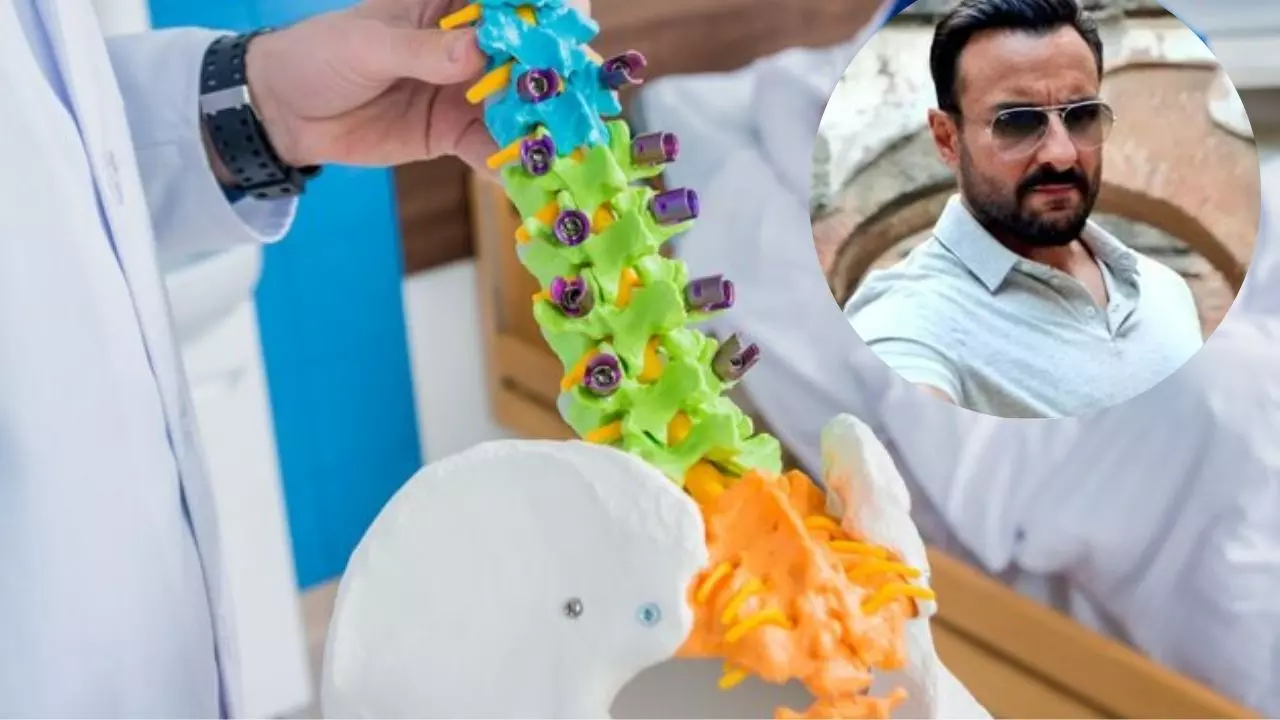 क्या है स्पाइनल फ्लूइड लीक? हमले में सैफ अली खान को हुई इंजरी, डॉक्टर ने बताया खतरा