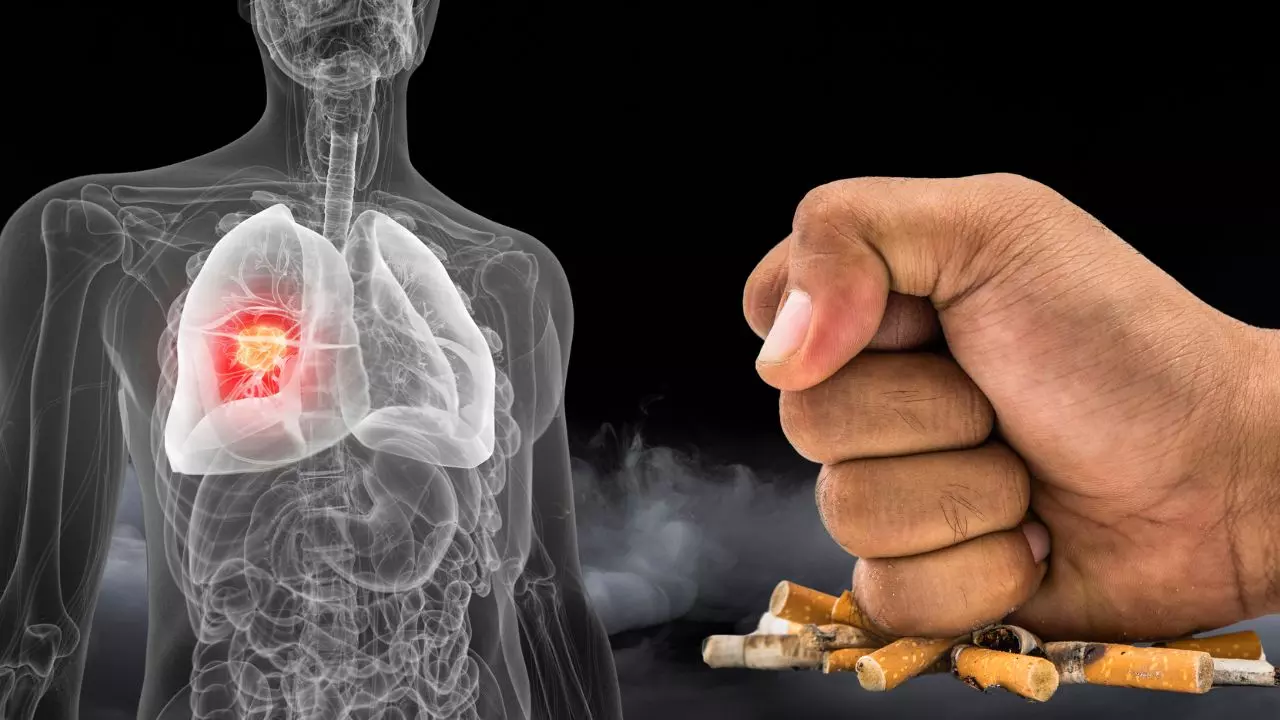 सिगरेट न पीने वालों में सबसे ज्यादा Lung Cancer का खतरा! लैंसेट की रिपोर्ट में चौंकाने वाला खुलासा सिगरेट न पीने वालों में सबसे ज्यादा Lung Cancer का खतरा! लैंसेट की रिपोर्ट में चौंकाने वाला खुलासा