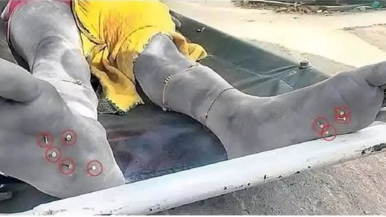 हाथ में पट्टी, बदन पर नाइटी, तलवे पर 9 कीलें, बिहार में महिला से दरिंदगी; तेजस्वी बोले- नीतीश को शर्म नहीं आती