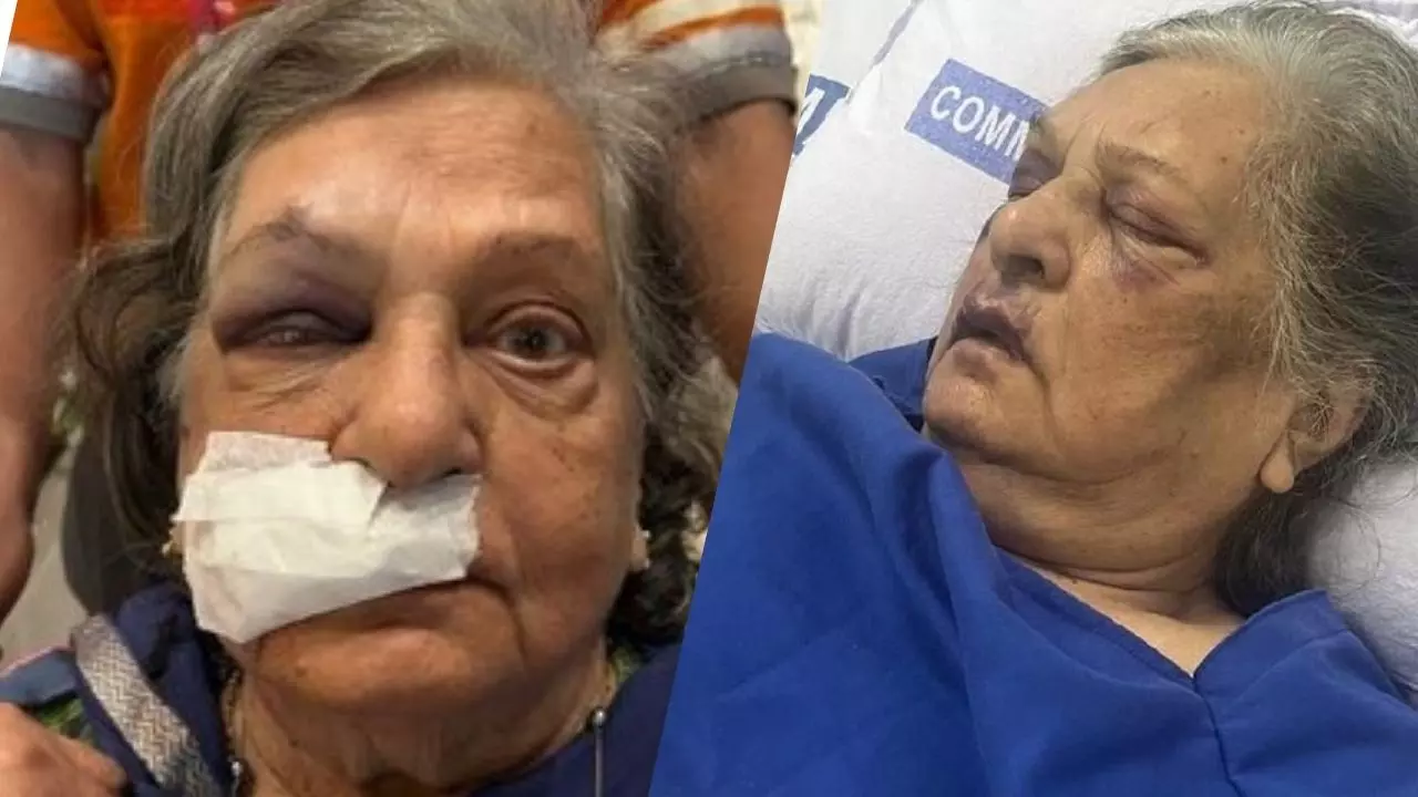एयर इंडिया ने व्हीलचेयर देने से किया इनकार, 82 वर्षीय महिला गिरने से बुरी तरह हुई घायल, पोती ने सुनाई आपबीती