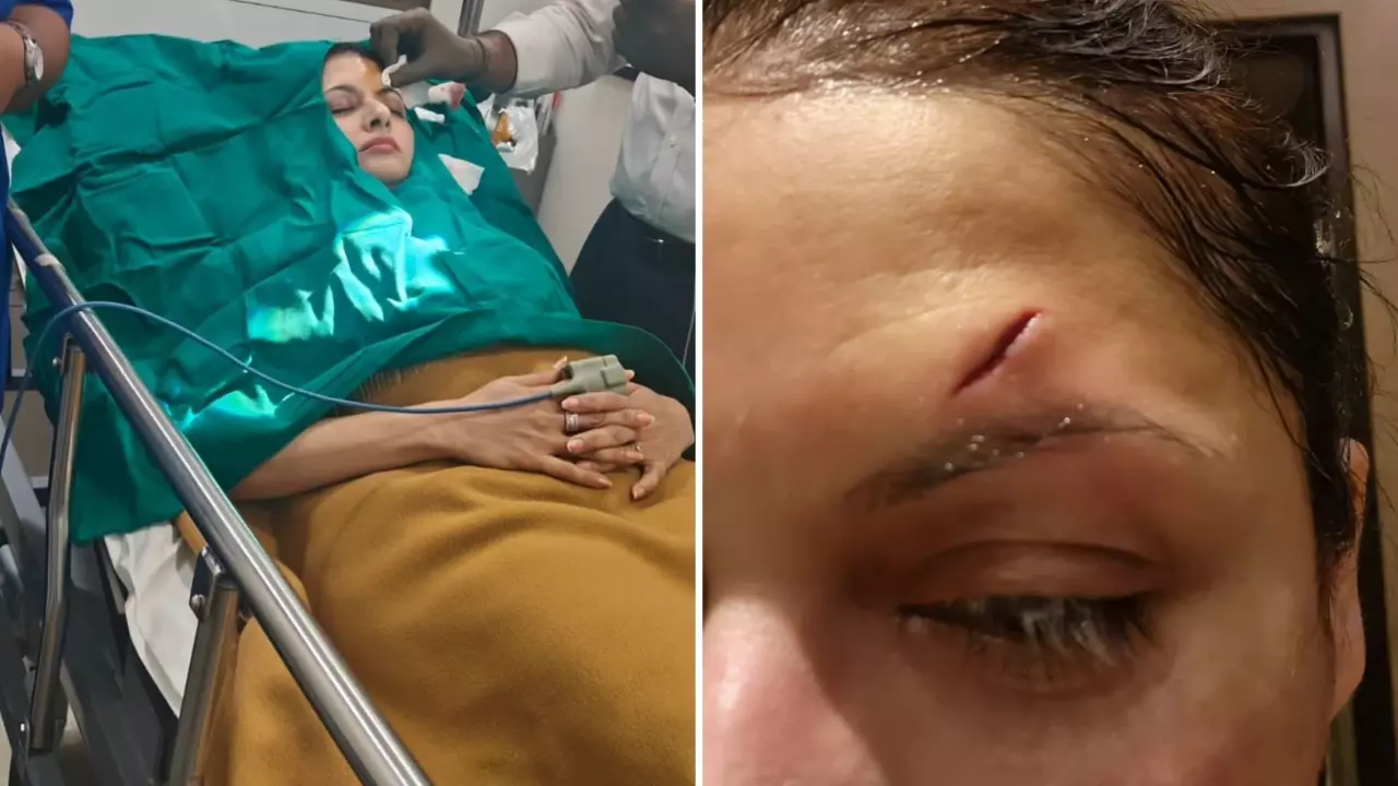 पिकलबॉल खेल रही थी Bhagyashree, सिर में आई गहरी चोट, लगे 13 टांके