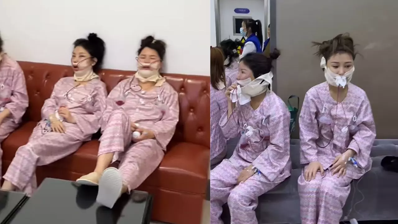 नाक-ठुड्डी पर पट्टियां, आंखों में दर्द! Viral Video ने दिखाई प्लास्टिक सर्जरी की दुनिया