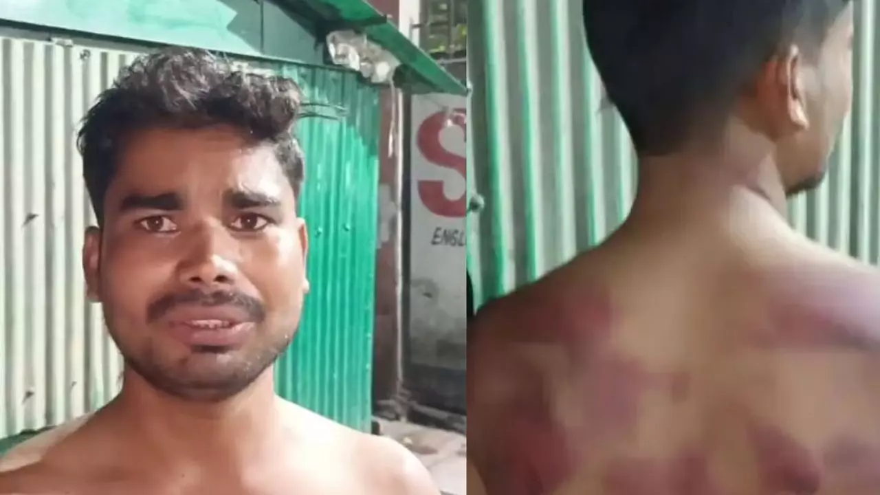 प्रेमिका के घरवालों ने युवक को नंगा कर पीटा, पेशाब पिलाया और प्राइवेट पार्ट पर...; VIDEO में सुनाई हैवानियत की कहानी प्रेमिका के घरवालों ने युवक को नंगा कर पीटा, पेशाब पिलाया और प्राइवेट पार्ट पर...; VIDEO में सुनाई हैवानियत की कहानी