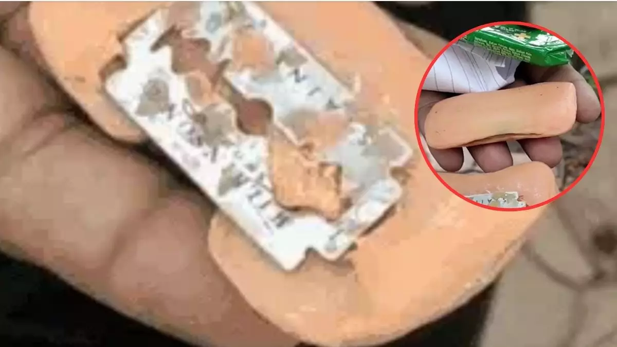 ग्वालियर में डिटॉल साबुन से निकला ब्लेड, नहाते वक्त 10 साल के बच्चे का कटा गाल; पिता ने उपभोक्ता फोरम में दर्ज कराया केस