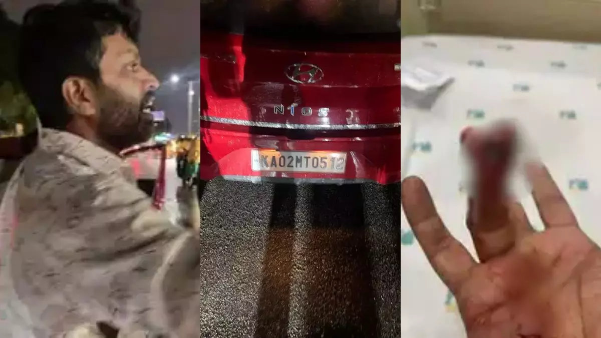 बेंगलुरु में रोड रेज का नया लेवल! गुस्से में बिजनेसमैन की काट डाली उंगली, सर्जरी में लगे 2 लाख रुपये; जानिए पूरा मामला बेंगलुरु में रोड रेज का नया लेवल! गुस्से में बिजनेसमैन की काट डाली उंगली, सर्जरी में लगे 2 लाख रुपये; जानिए पूरा मामला