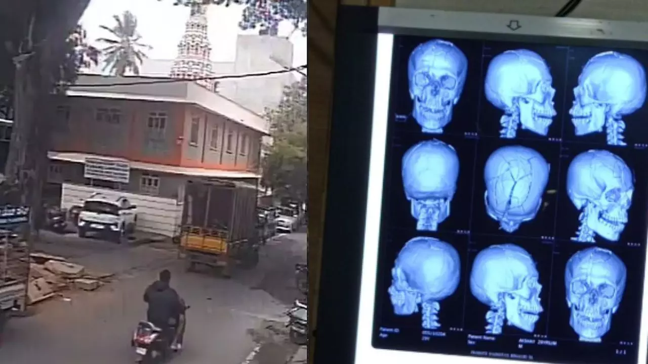 बाइक सवार पर गिरी पेड़ की टहनी, सिर के 12 टुकड़े! वायरल वीडियो देख रूह कांप जाएगी
