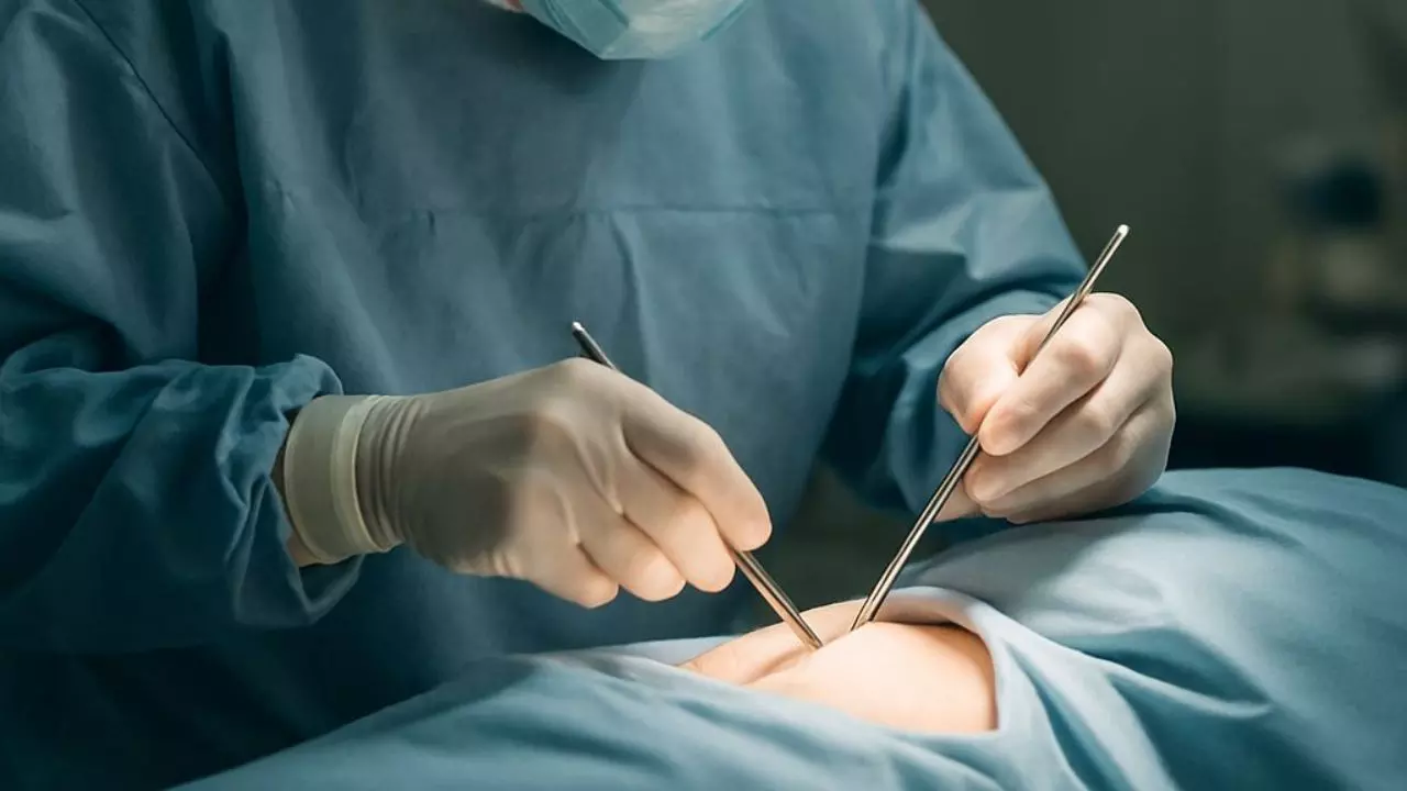 2 साल से सूज रहा था पेट, ऑपरेशन में सामने आया ऐसा सच कि डॉक्टर्स के उड़ गए होश