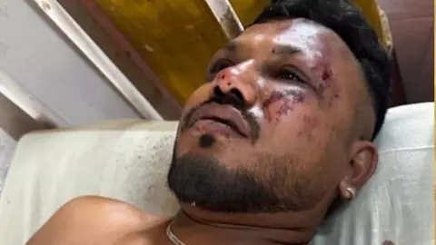 मैं अकेला बचा, लेकिन ज़िंदा रहना अब सज़ा लगती है”, बोले अहमदाबाद एयर इंडिया क्रैश के इकलौते सर्वाइवर मैं अकेला बचा, लेकिन ज़िंदा रहना अब सज़ा लगती है”, बोले अहमदाबाद एयर इंडिया क्रैश के इकलौते सर्वाइवर