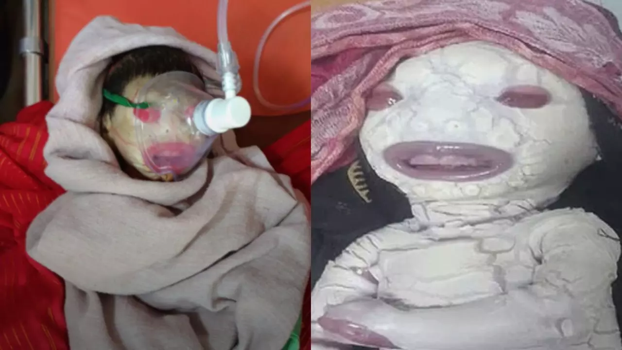 ना आंख न नाक... बस एलियन जैसी शक्ल! MP के रीवा में पैदा हुआ रहस्यमयी बच्चा; रिपोर्ट्स से खुला ये राज