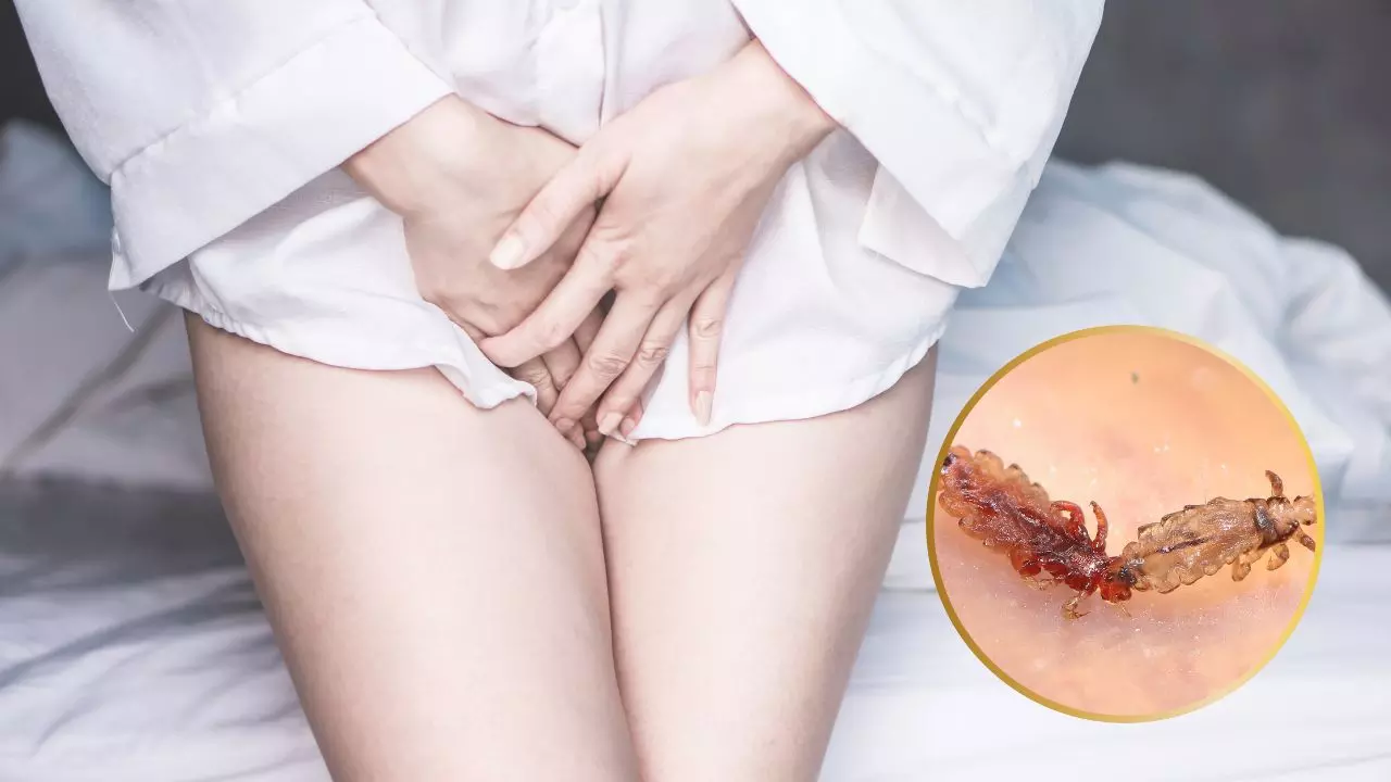 क्या आप जानते हैं प्यूबिक हेयर में होती हैं जुएं? SEX है वजह! जानें ट्रीटमेंट