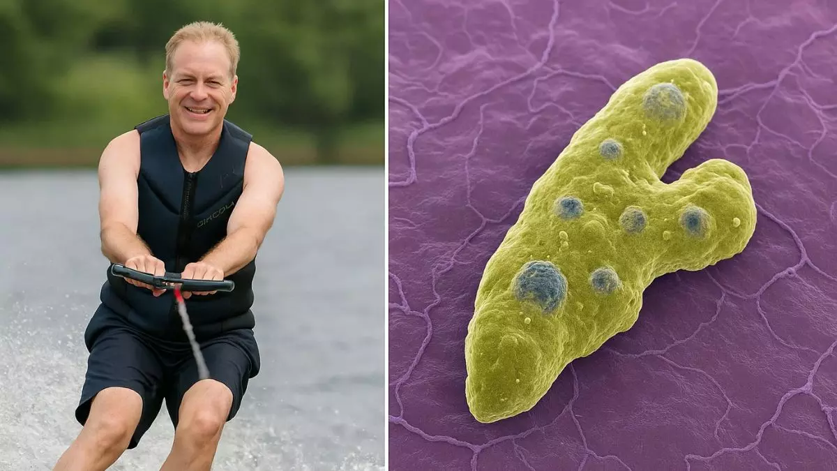 वाटर स्कीइंग का शौक बना जानलेवा! अमेरिका में ‘ब्रेन-ईटिंग अमीबा’ से शख्स की मौत, जानिए इसके लक्षण और बचाव के उपाय