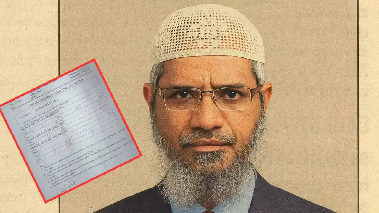लीक हो गई Zakir Naik की AIDS रिपोर्ट! सोशल मीडिया पर  Viral पोस्ट देख यूजर्स बोले- Very Sad