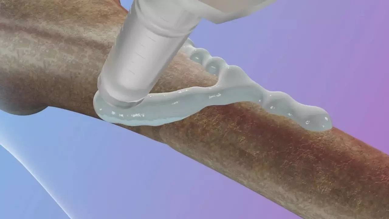 मात्र 2 मिनट में जुड़ जाएगी टूटी हड्डी! चीन ने तैयार किया पहला ‘Bone Glue’, ऑर्थोपेडिक सर्जरी में होगी क्रांति? मात्र 2 मिनट में जुड़ जाएगी टूटी हड्डी! चीन ने तैयार किया पहला ‘Bone Glue’, ऑर्थोपेडिक सर्जरी में होगी क्रांति?