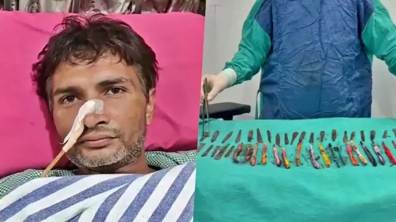 गजब हो गया! हापुड़ में शख्स के पेट से निकले 29 चम्मच, 19 टूथब्रश और दो पेन, डॉक्टर का भी घूमा माथा गजब हो गया! हापुड़ में शख्स के पेट से निकले 29 चम्मच, 19 टूथब्रश और दो पेन, डॉक्टर का भी घूमा माथा