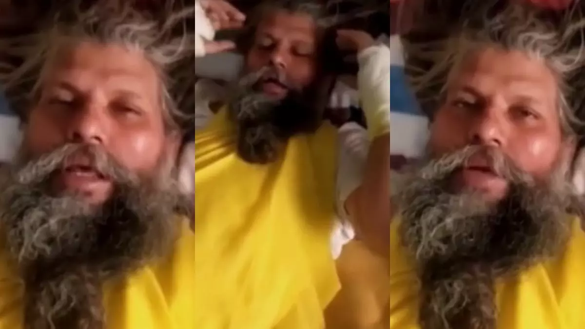 शरीर में सूजन, दोनों हाथों पर बंधी पट्टियां... संत प्रेमानंद महाराज की अब कैसी है सेहत? पदयात्रा स्थगित होने से भक्तों में चिंता का माहौल