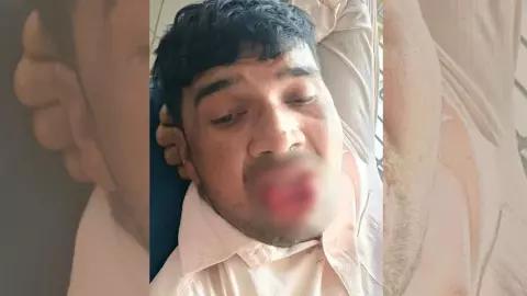 शादीशुदा युवक Ex Girlfriend को जबरन कर रहा था KISS, युवती ने काट ली जीभ, पुलिस ने दर्ज मामला किया