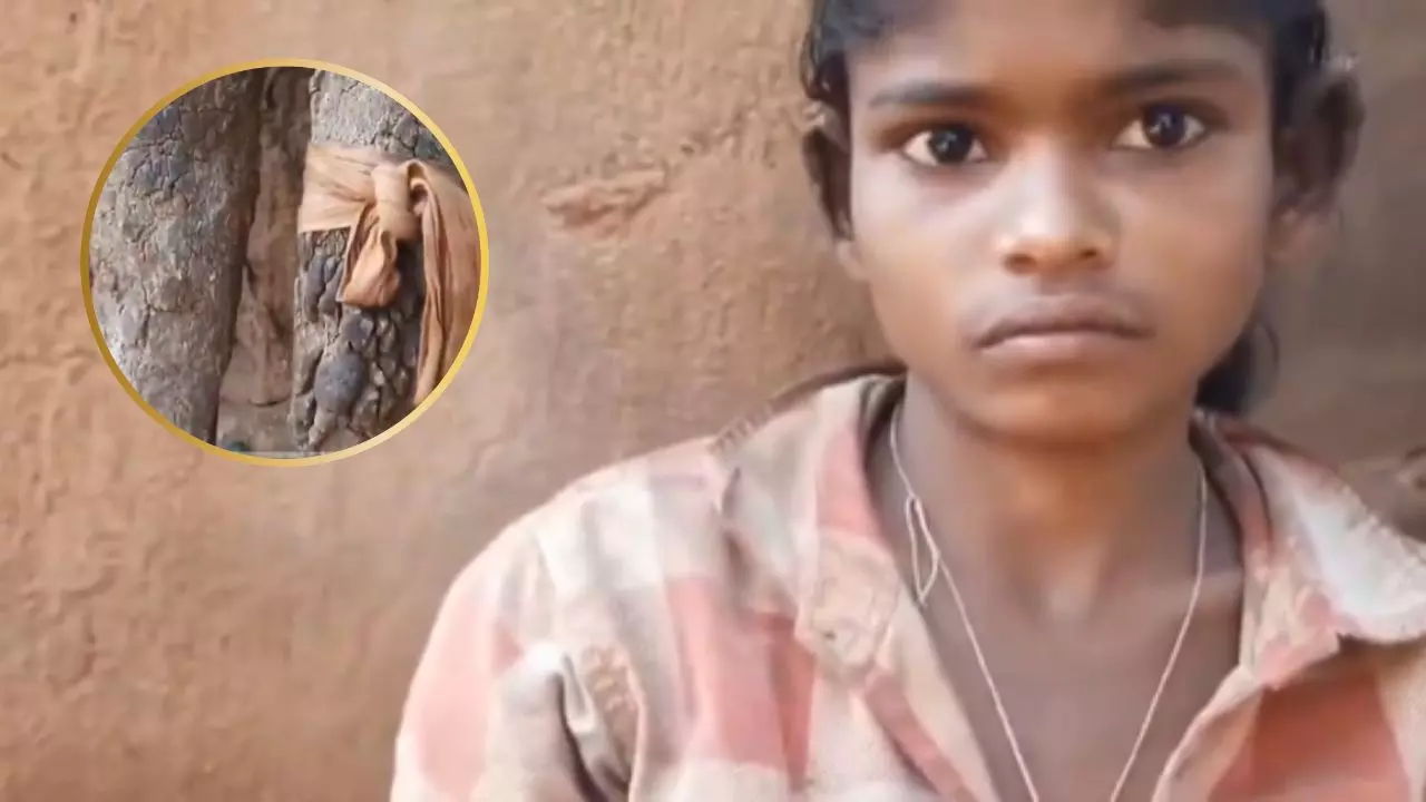छत्तीसगढ़ में पत्थर की होती जा रही है 14 साल की राजेश्वरी, क्या है Ichthyosis Hystrix बीमारी? परिवार ने बचाने की लगाई गुहार