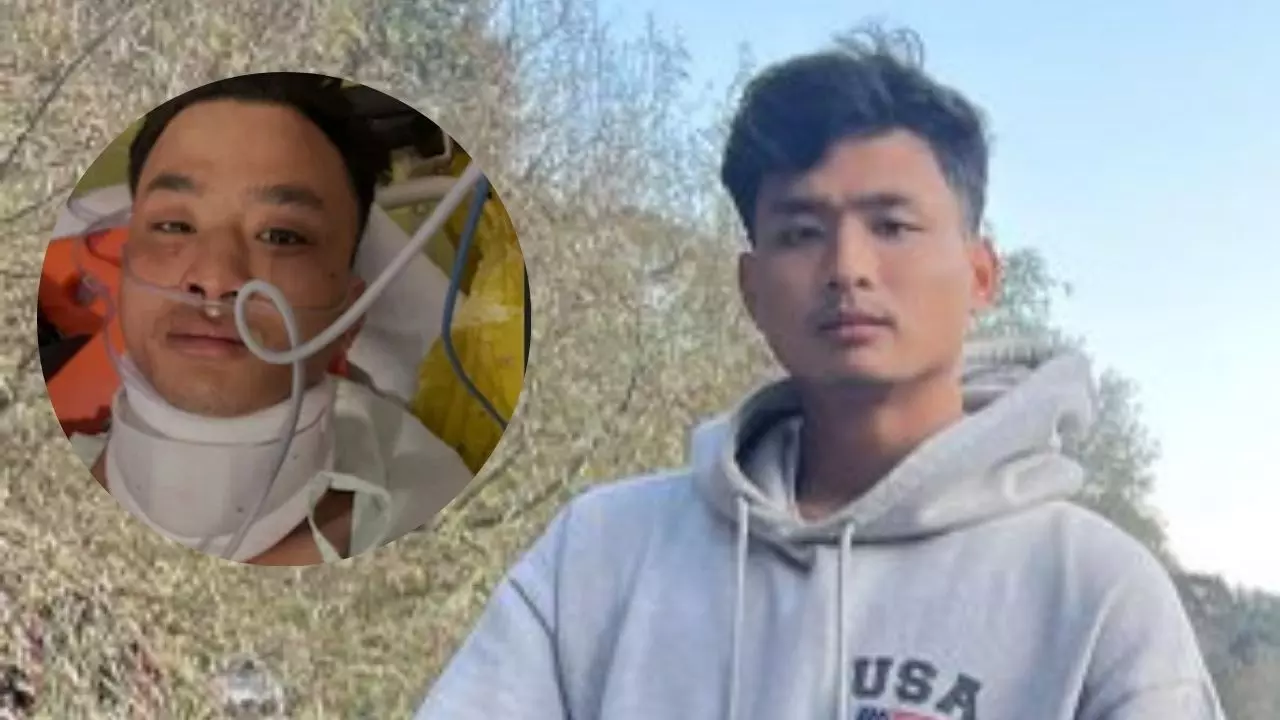 चीनी, चिंकी, मोमो इन शब्दों से चिढ़ाया, फिर कड़े से किया वार;  Angel Chakma Murder Case में पुलिस ने बताई पूरी कहानी