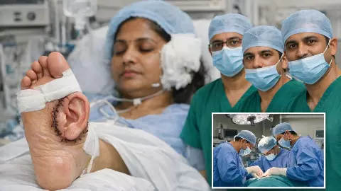 हादसे में महिला के कटे कान को डॉक्टर्स ने पैर से जोड़ा, 10 घंटे चली इस सर्जरी के बारें जानें सब कुछ