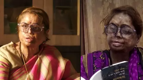 Padma Awards 2026: कौन हैं उत्तर प्रदेश की प्रो. मंगला कपूर? 12 साल की उम्र में हुआ एसिड अटैक; संगीत को बनाई दुनिया