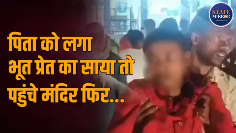 डॉग के काटने के 4 महीने बाद कुत्ते की तरह भौंकने लगा नाबालिग, 49 सेकेंड के इस वीडियो को देखकर उड़ जाएंगे आपके होश