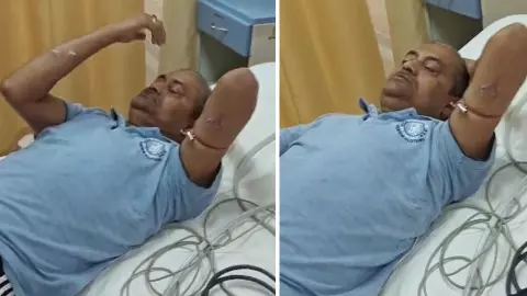 ग्रेटर नोएडा में कुत्तों का आतंक! पूर्व रक्षा अधिकारी को 13 जगह काटा, दर्दनाक तस्वीर आई सामने