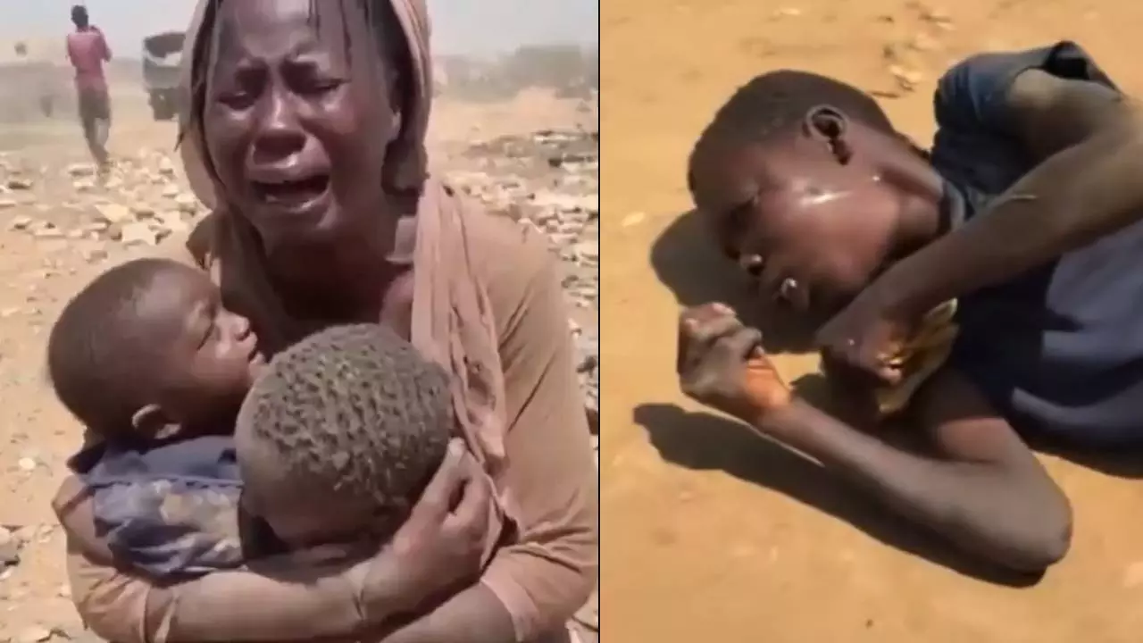 सबकी ईरान जंग पर नजर, लेकिन हर रोज तिल-तिल मर रहा ये मुस्लिम देश, भुखमरी की कगार पर 80 लाख लोग