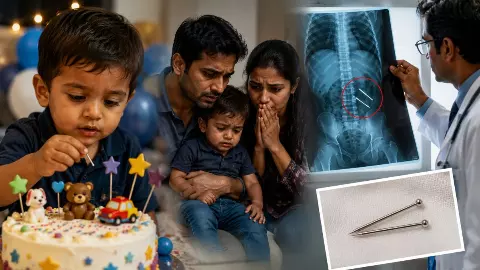 Thane Birthday Cake Horror 3-Year-Old Swallows Metal Pins Thane Birthday Cake Horror 3-Year-Old Swallows Metal Pins