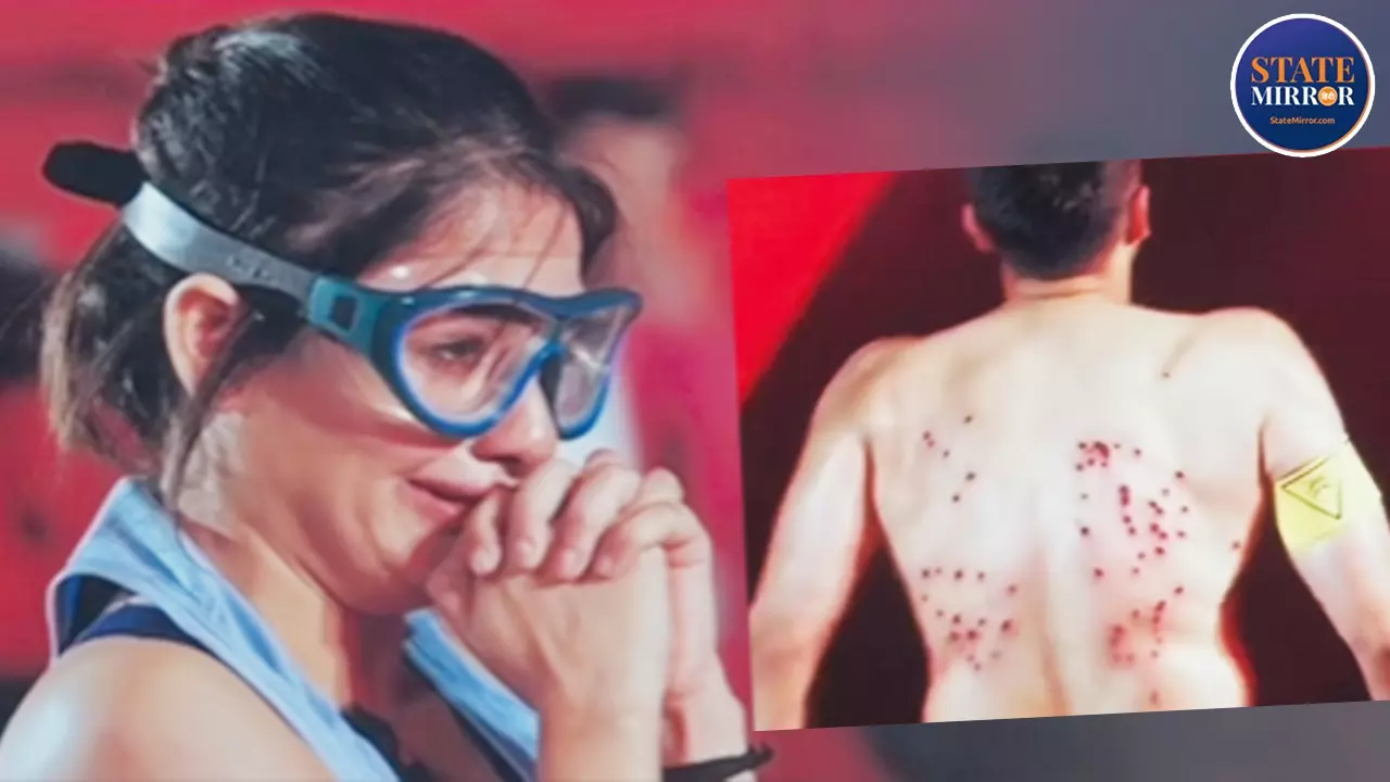 खतरों के खिलाड़ी में ये कैसा स्टंट? रबड़ बुलेट के हिट से बिलख पड़ीं शगुन शर्मा, गौरव खन्ना की पीठ पर दिखे निशान