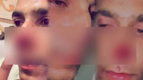बाइक टकराई और शुरू हो गया बवाल, ग्रेटर नोएडा में 3 युवकों ने सेना के जवान को घेरकर काटी नाक, 2 गिरफ्तार बाइक टकराई और शुरू हो गया बवाल, ग्रेटर नोएडा में 3 युवकों ने सेना के जवान को घेरकर काटी नाक, 2 गिरफ्तार