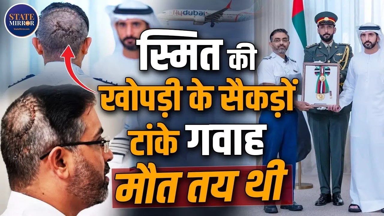 सिर पर टांके, हाथ पर प्लास्टर... 174 जिंदगियां बचाने वाले कैप्टन  स्मित मच्छार को देख Dubai के सुलतान हुए हैरान