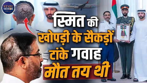 सिर पर टांके, हाथ पर प्लास्टर... 174 जिंदगियां बचाने वाले कैप्टन स्मित मच्छार को देख Dubai के सुलतान हुए हैरान सिर पर टांके, हाथ पर प्लास्टर... 174 जिंदगियां बचाने वाले कैप्टन स्मित मच्छार को देख Dubai के सुलतान हुए हैरान
